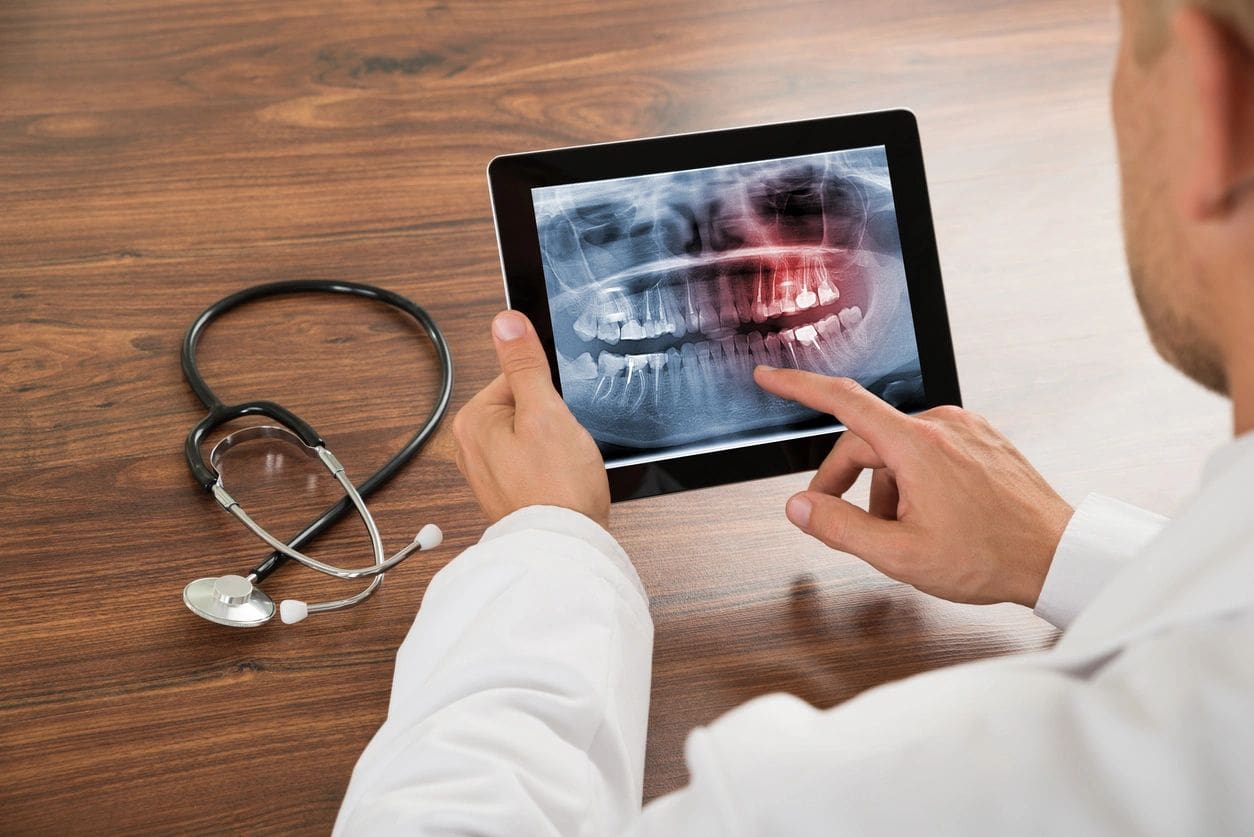 A doctor looking at an x-ray on his tablet.